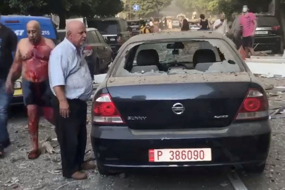 A wounded man walks next to a damaged car on a street, following an explosion in Beirut  / INSTAGRAM/MICHEL.ABBOUD