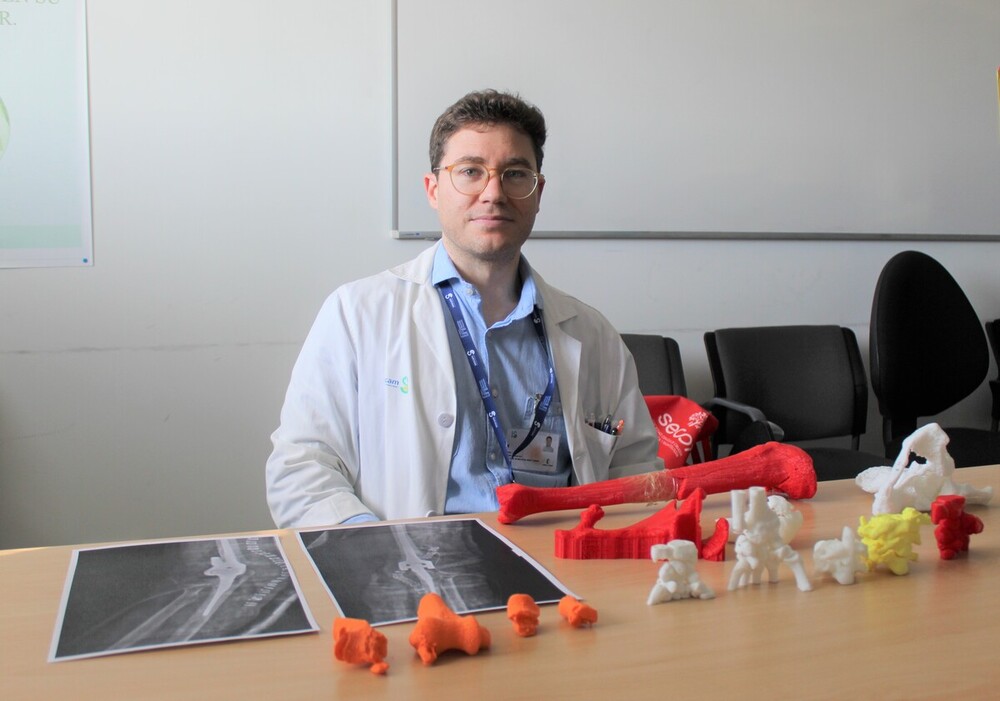 El uso de tecnología 3D, clave en Traumatología del Hospital