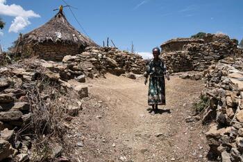 Más de 150 personas mueren por un brote de cólera en Etiopía